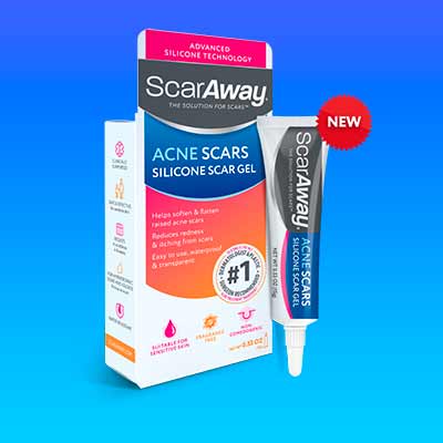 free scaraway silicone acne scar gel - FREE ScarAway Silicone Acne Scar Gel