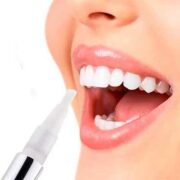 free teeth whitening pen 180x180 - FREE Teeth Whitening Pen