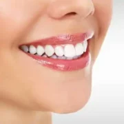 free whitening toothpaste 3 180x180 - FREE Whitening Toothpaste